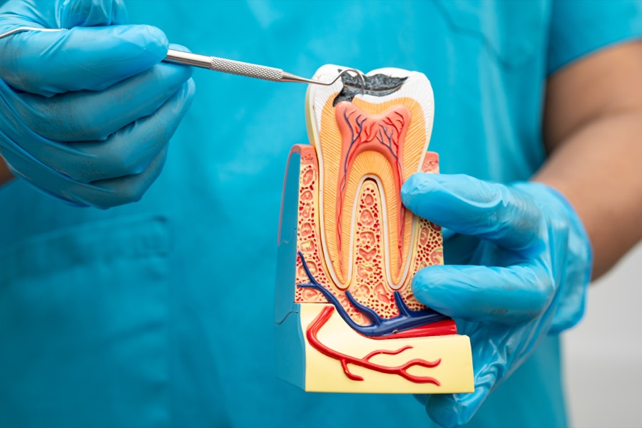 Comfort-first root canal treatment